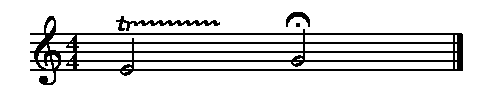 Picture of Mup output